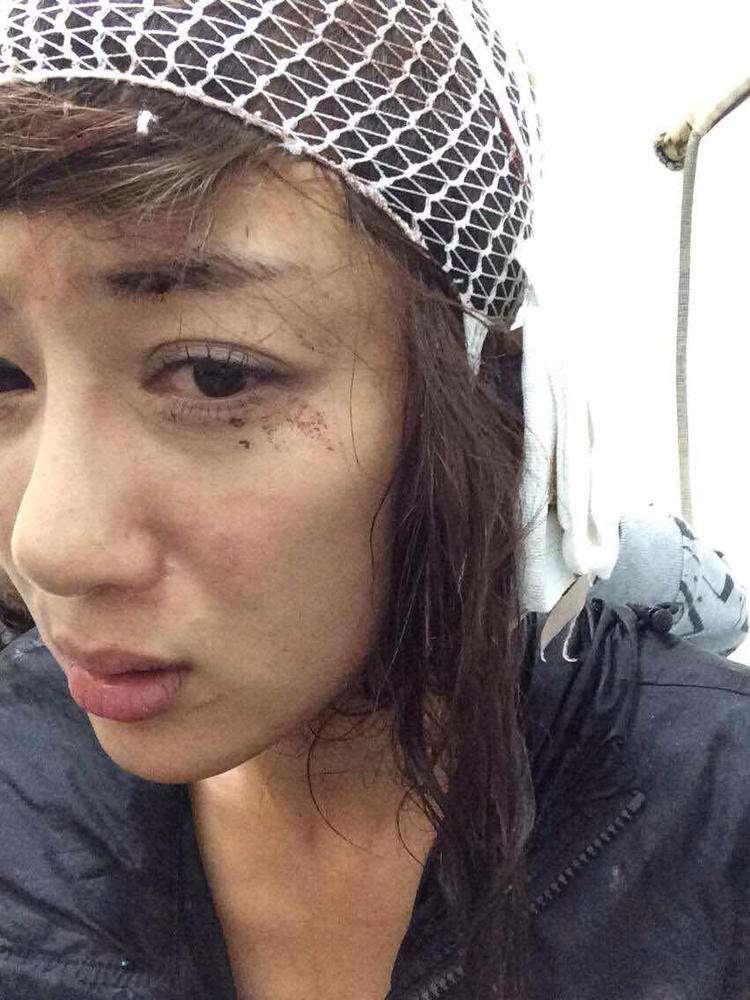 明星整容毀容最嚴(yán)重的是誰(shuí)，深度探討與反思，深度探討與反思，哪位明星整容遭遇最慘重的毀容？