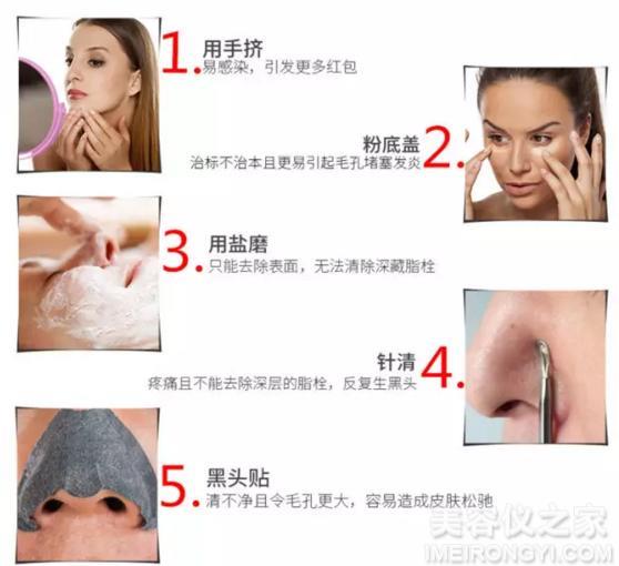 去黑頭的簡單小妙招，去黑頭小妙招分享，輕松告別黑頭困擾