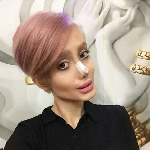 整容最瘋狂的女人，背后的故事與心理探索，整容狂熱背后的女人故事與心理揭秘
