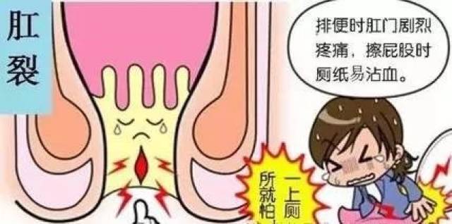 肛裂怎么快速愈合，藥物治療與護理建議，肛裂快速愈合方法，藥物治療與護理建議攻略