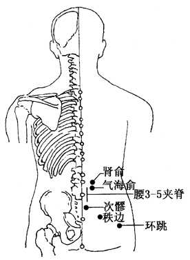 坐骨神經(jīng)痛的治療方法，哪種方式能最快緩解你的疼痛？，坐骨神經(jīng)痛快速緩解方法與治療方式探討