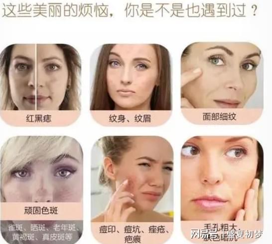 激光祛斑真害人？深度解析激光祛斑的利與弊，深度解析，激光祛斑的利弊與潛在風(fēng)險(xiǎn)揭秘