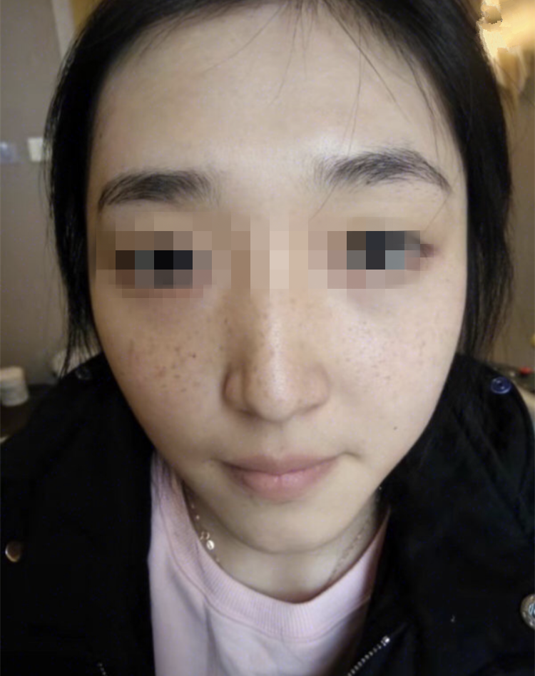 正規(guī)醫(yī)院祛斑效果深度解析，安全與效果的雙重保障，正規(guī)醫(yī)院祛斑效果深度解析，雙重保障下的安全與效果體驗