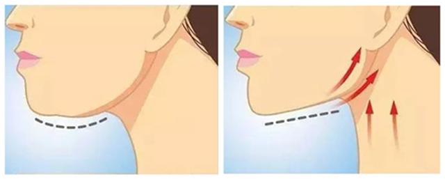 如何排出臉上的毒素——打造健康肌膚光彩，臉部排毒秘訣，打造健康肌膚光彩的秘訣